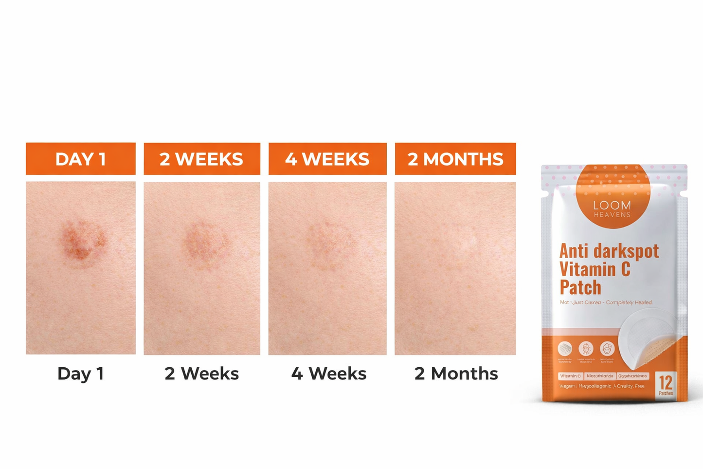 Loom Heavens Vitamin C Dark Spot Patches – Microneedle Patch for Hyperpigmentation, 12 Patches