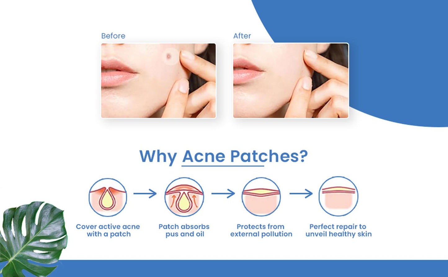 Loom Heavens-Invisible Spot Shield- 63 Hydrocolloid Pimple Patches