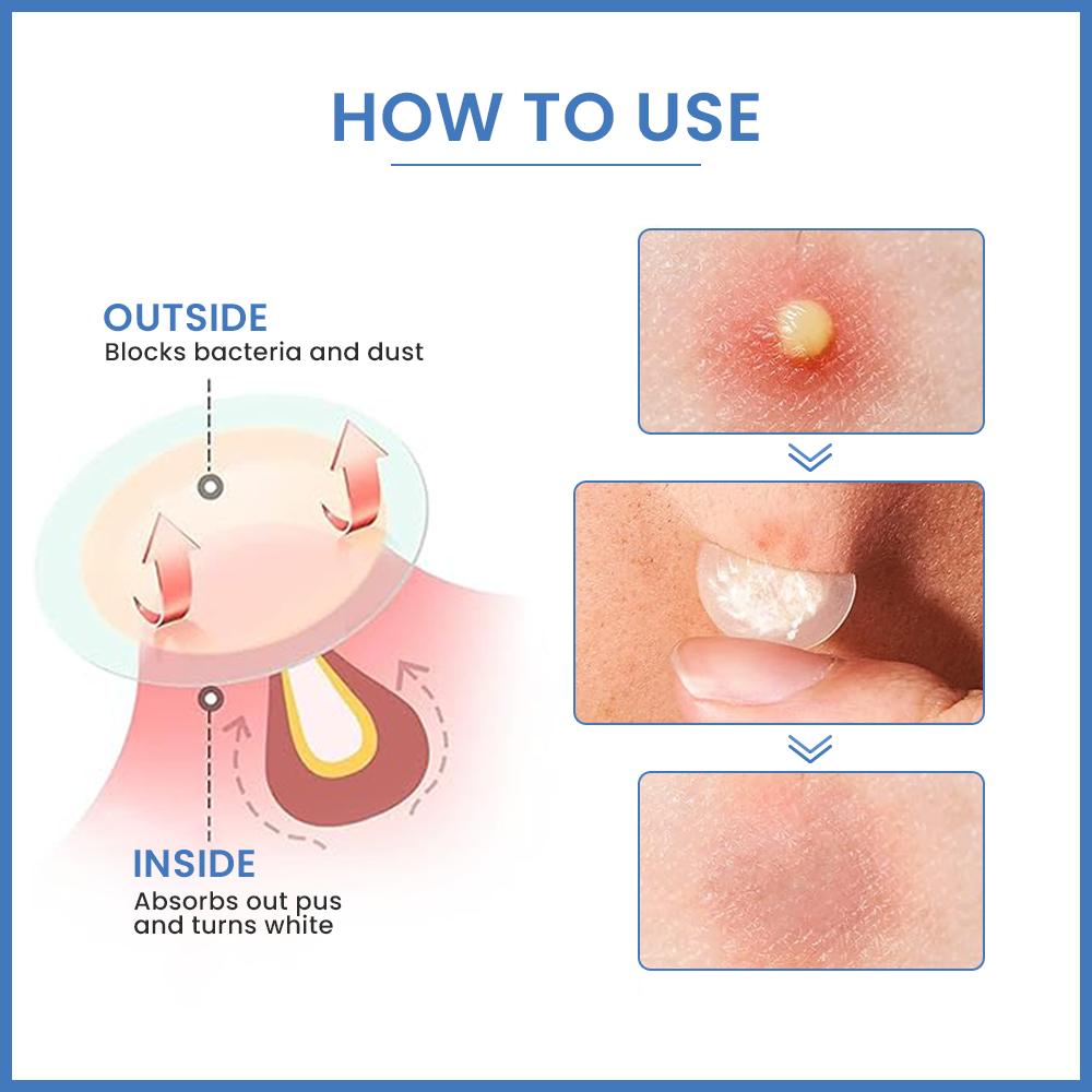 Loom Heavens-Invisible Spot Shield- 63 Hydrocolloid Pimple Patches